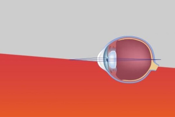 Shamir Optical Industry