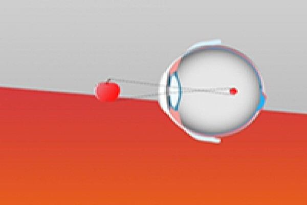 Shamir Optical Industry