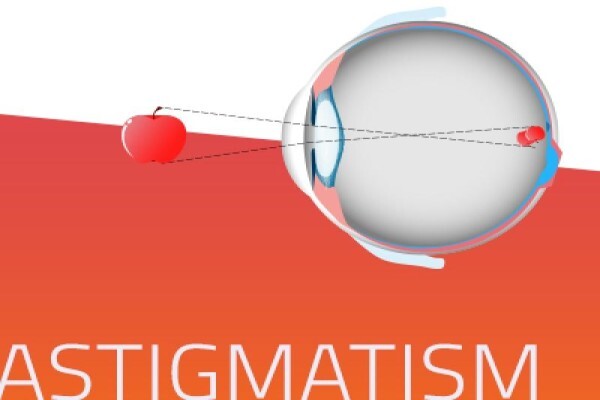 Shamir Optical Industry