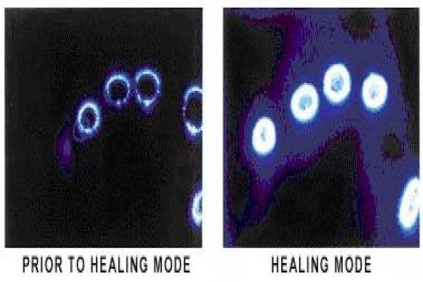 Reconnective Healing And The Reconnection