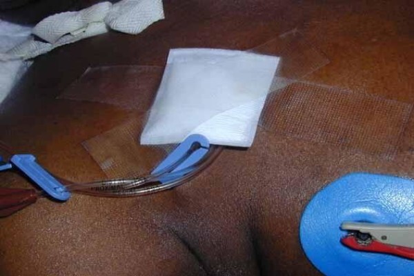 Cerdak