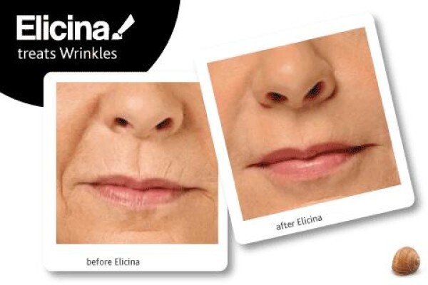 Elicina