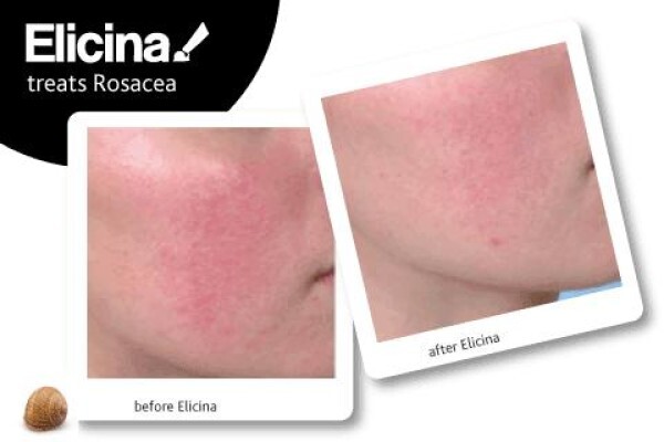 Elicina