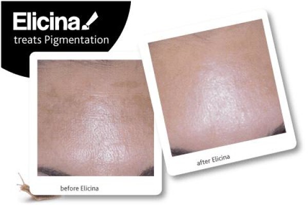 Elicina