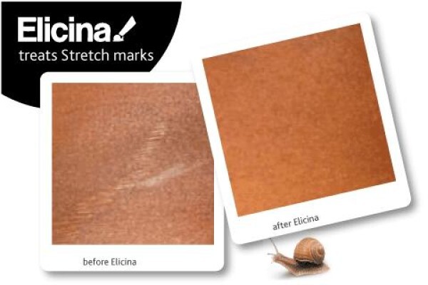 Elicina