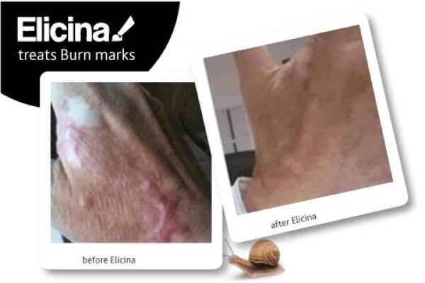 Elicina