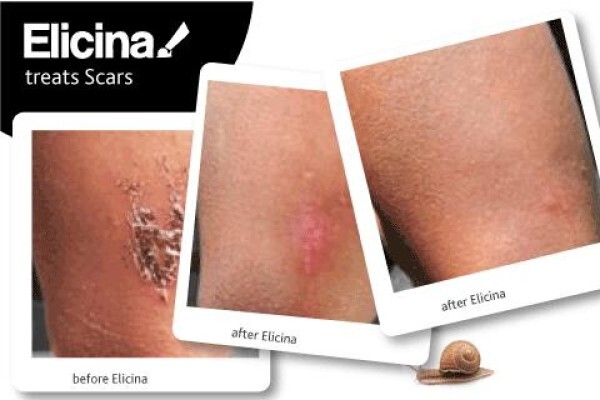 Elicina
