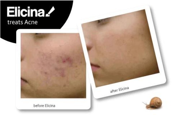 Elicina
