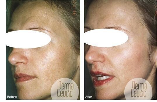 Advanced Skin Clinic