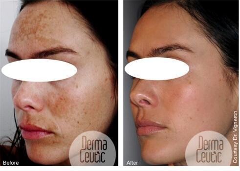 Advanced Skin Clinic