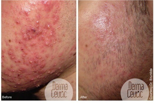Advanced Skin Clinic