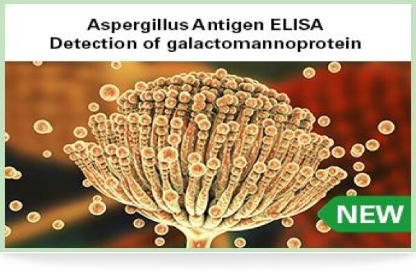 Euroimmun Medical Laboratory Diagnostics South Africa