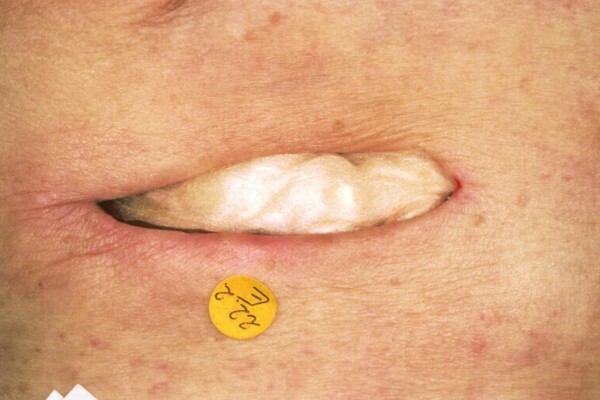 Hartmann Vitamed