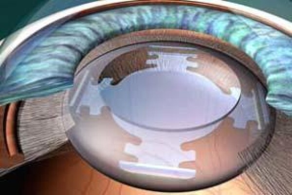 Healthy Eye