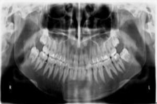 Maxillo-Facial Surgeon