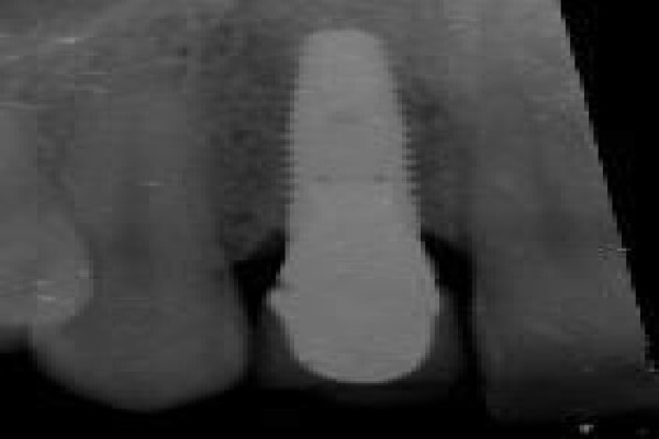 Maxillo-Facial Surgeon