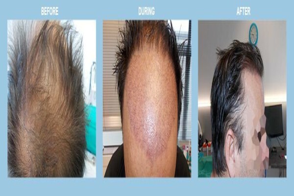 Medhair - Hair Loss Clinic