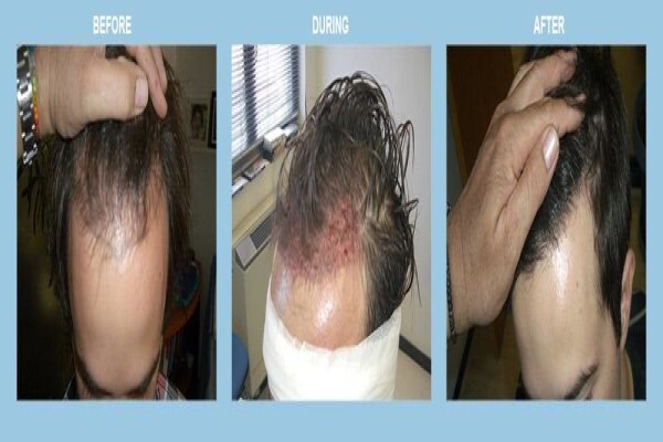 Medhair - Hair Loss Clinic