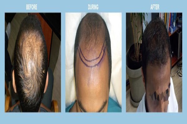 Medhair - Hair Loss Clinic
