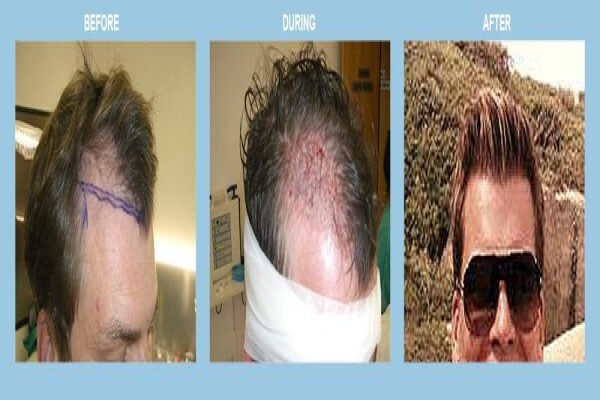 Medhair - Hair Loss Clinic