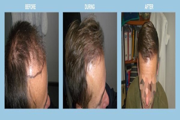 Medhair - Hair Loss Clinic