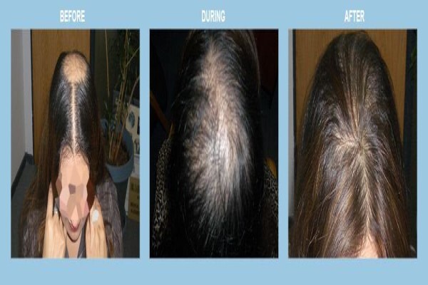 Medhair - Hair Loss Clinic