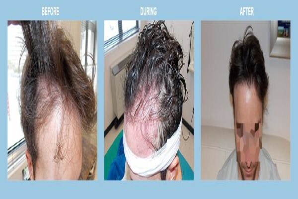 Medhair - Hair Loss Clinic