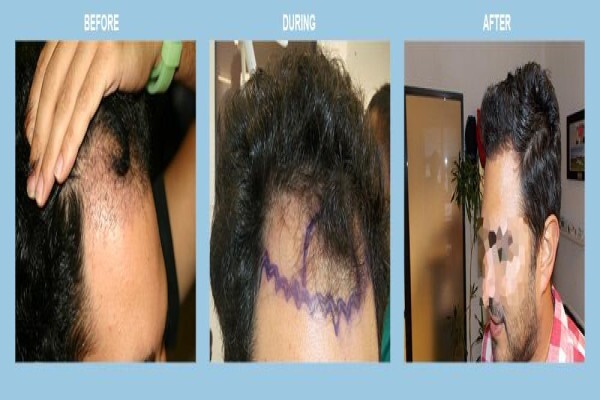 Medhair - Hair Loss Clinic