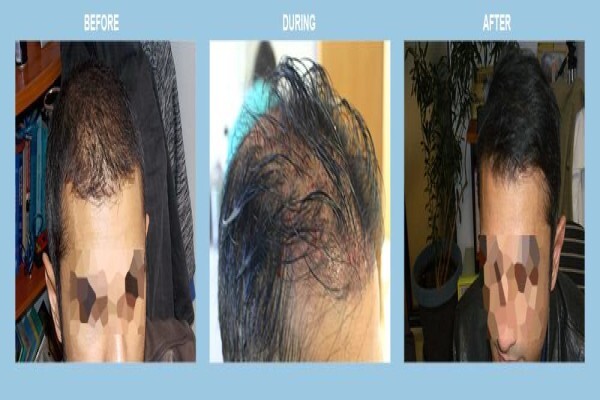 Medhair - Hair Loss Clinic