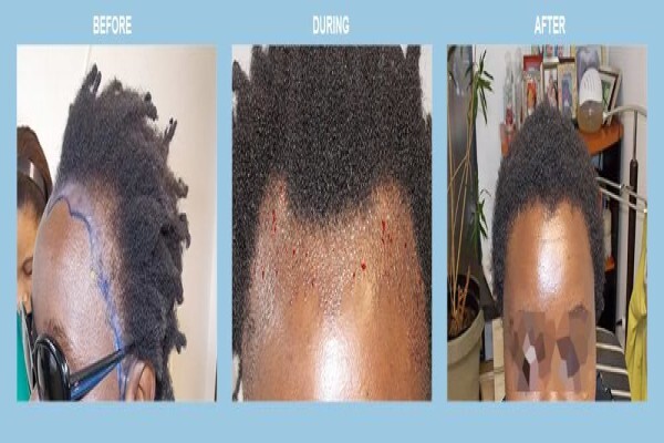 Medhair - Hair Loss Clinic