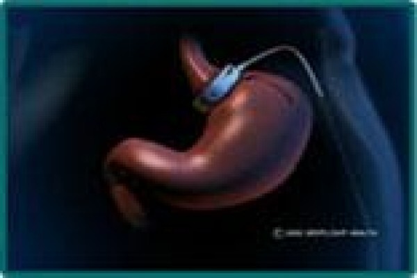 Obesity Unit