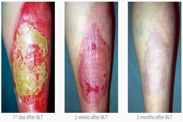 Bioptron South Africa