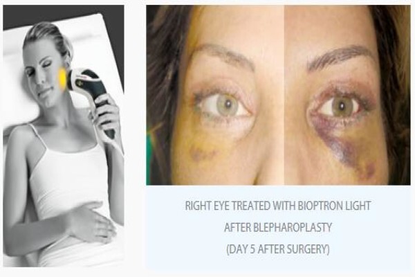 Bioptron South Africa