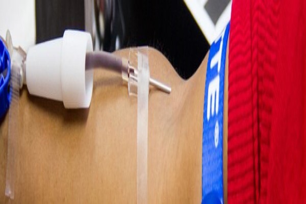 S A National Blood Service