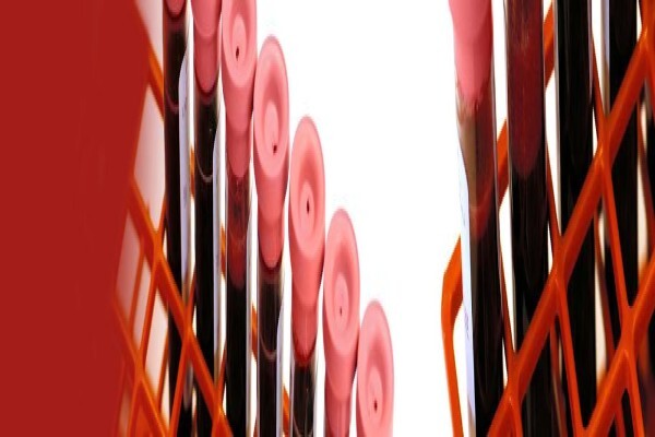 S A National Blood Service