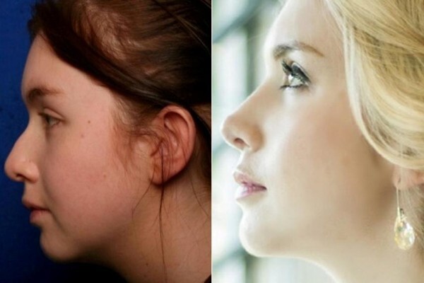The Nose Clinic