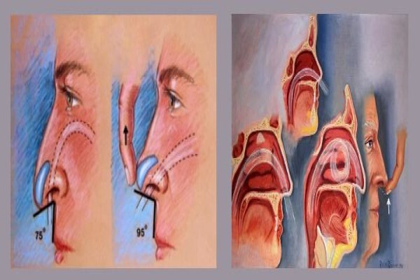 The Nose Clinic