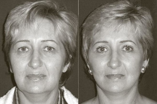 Somerset Aesthetic Surgery