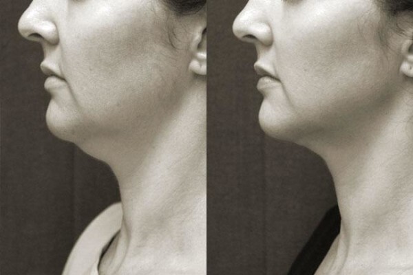 Somerset Aesthetic Surgery