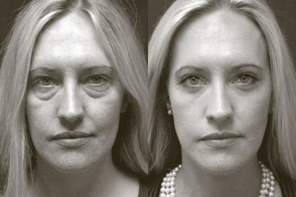 Somerset Aesthetic Surgery