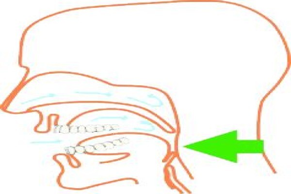 The Snore Clinic