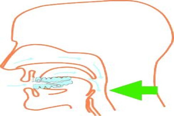 The Snore Clinic