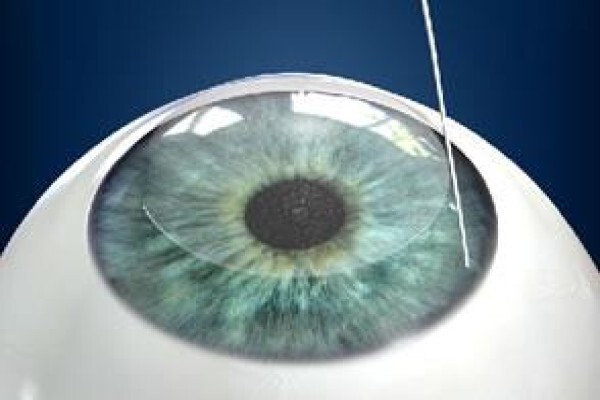 Visiomed