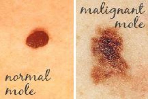 Westville Laser Clinic
