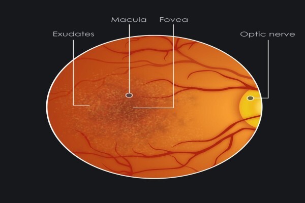 Davida Van Der Merwe Optometrists