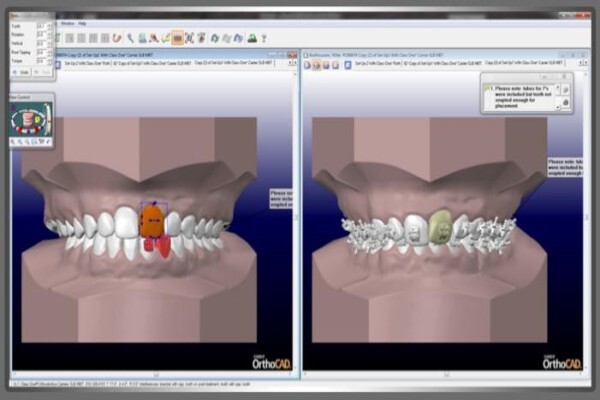 Dentist / Tandarts
