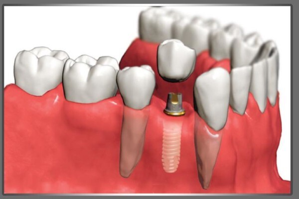 Dentist / Tandarts