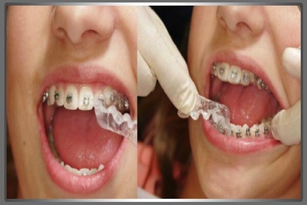 Dentist / Tandarts