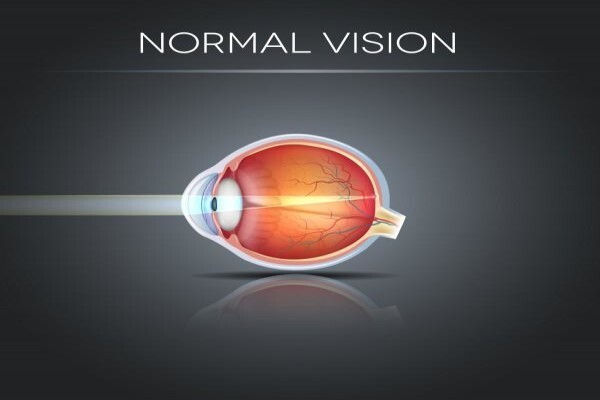 Charl Laäs Optometrists