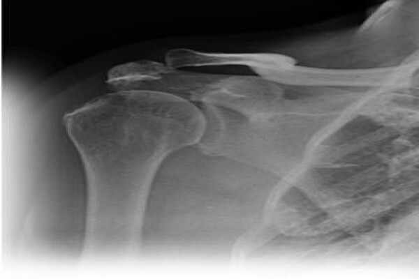 Dr Hugo Basson - Cape Town Orthopaedic Surgeon